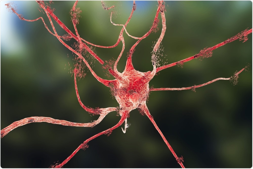 Apoptosis (cell death) of a neuron after ischemic injury to the brain.