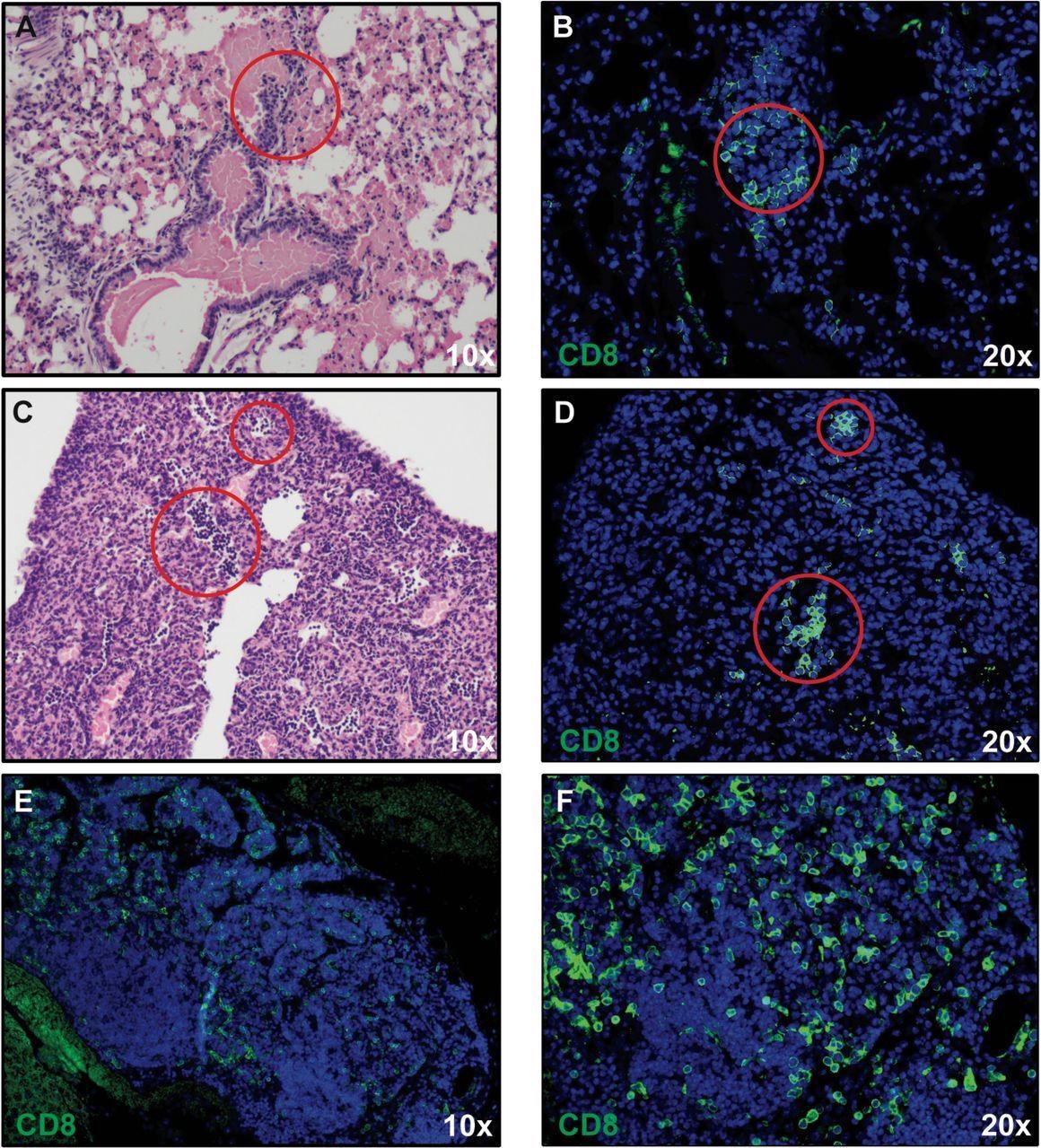 CD8+ T cell infiltration into lungs of SARS-CoV-2-infected mice. H&E staining of lungs of SARS-CoV-2 infected mice at day 7 post-infection reveal inflammation (A and C) associated with CD8+ T cell infiltration (B and D) as determined by immunofluorescent staining. Lymph node-like structures were also detected containing CD8+ T cells (E and F). Panels A, C, and E 10X magnification; panels B, D, and F 20X magnification.