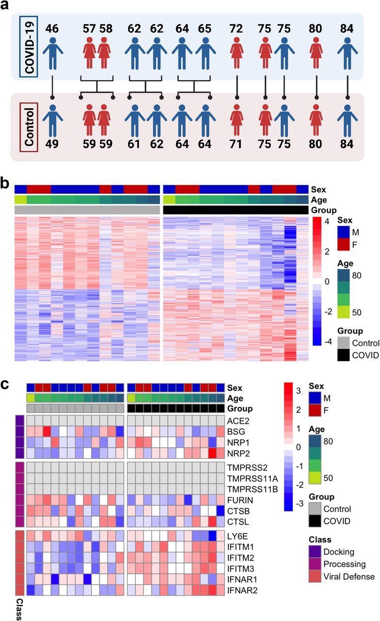 Overview of differential expression patterns in frontal cortex of COVID-19 and uninfected subjects. a. Age and sex matching used for differential expression analysis. b. Heatmap of relative gene expression levels of all significant DEGs (FDR < 0.05) across COVID-19 and control samples. Color legend, scaled gene expression levels across subjects, normalized via variance-stabilized transformation. c. Heatmap of relative expression levels of genes previously implicated in SARS-CoV-2 viral entry in the human brain [8] across COVID-19 and control samples. Color legend, scaled gene expression levels across patients, normalized via variance-stabilized transformation. Light gray cells, no aligned reads or genes filtered out of analysis.