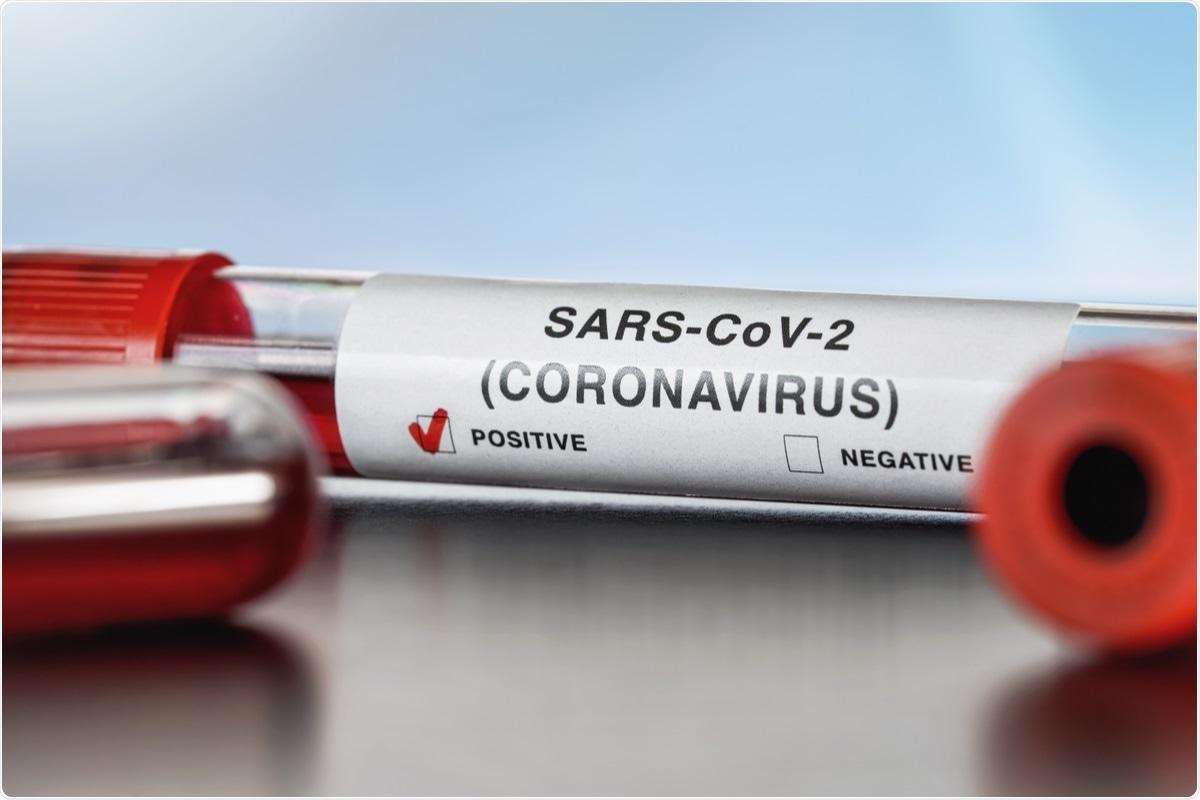 Study: Neutralizing antibodies to SARS-CoV-2 Omicron variant after 3rd mRNA vaccination in health care workers and elderly subjects and response to a single dose in previously infected adults. Image Credit: Lubo Ivanko / Shutterstock.com