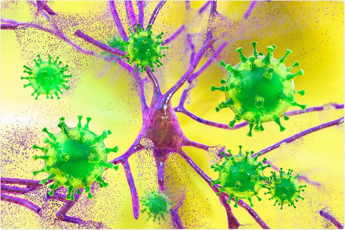 Study: SARS-CoV-2 Infection of Microglia Elicits Pro-inflammatory Activation and Apoptotic Cell Death. Image Credit: Kateryna Kon / Shutterstock.com