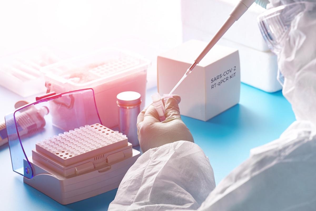 Study: Development of the one-step qualitative RT-PCR assay to detect SARS-CoV-2 Omicron (B.1.1.529) variant in respiratory specimens. Image Credit: anyaivanova/Shutterstock