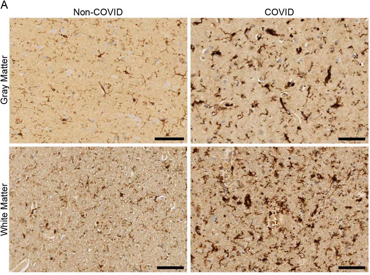 Reactividad microglial selectiva de materia blanca en humanos con infección por SARS-CoV-2 (A) Micrografías representativas de inmunotinción de IBA1 (marrón) en la corteza cerebral (materia gris) o materia blanca subcortical de sujetos humanos con o sin COVID.  Barras de escala 100μm.