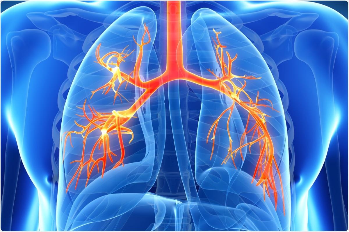 Study: Shift of lung macrophage composition is associated with COVID-19 disease severity and recovery. Image Credit: SciePro / Shutterstock.com