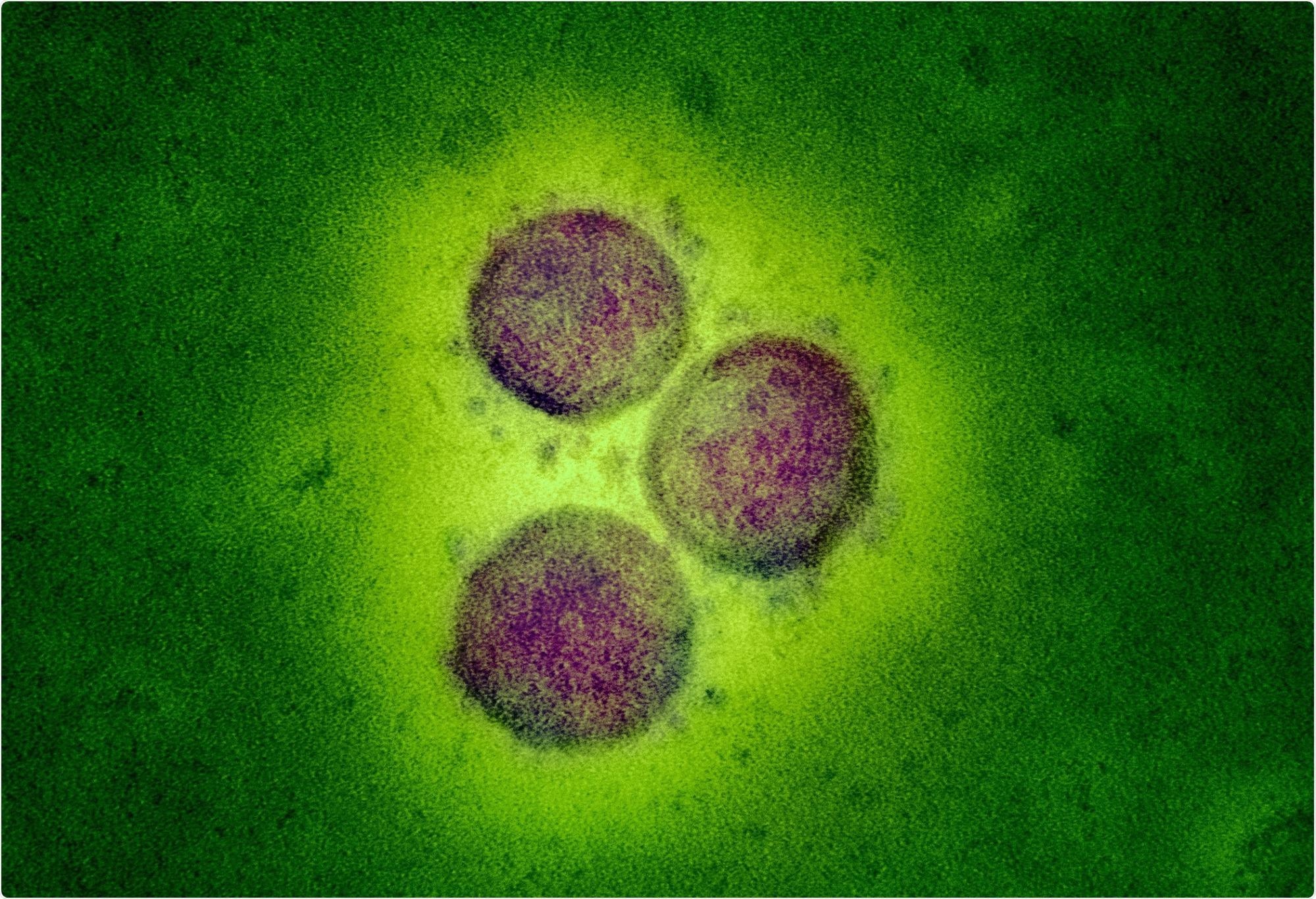 Study: The Effects of SARS-CoV-2 Infection on Female Fertility: A Review of the Literature. Image Credit: NIAID
