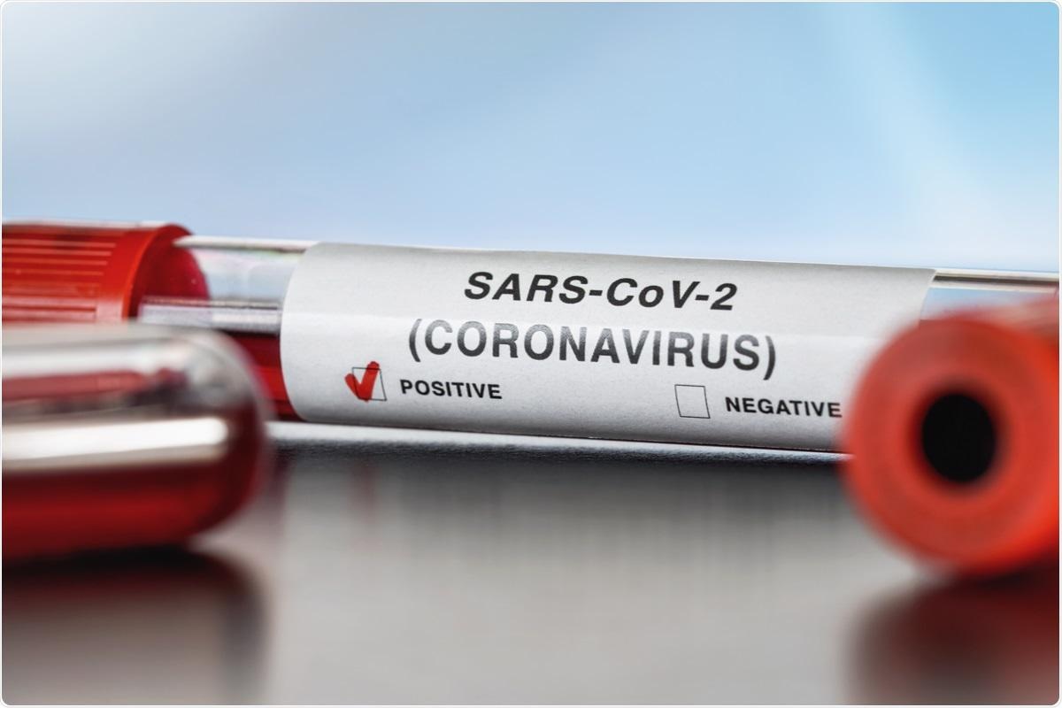 Study: SARS-CoV-2 Cross-Reactivity in Prepandemic Serum from Rural Malaria-Infected Persons, Cambodia. Image Credit: Lubo Ivanko / Shutterstock.com