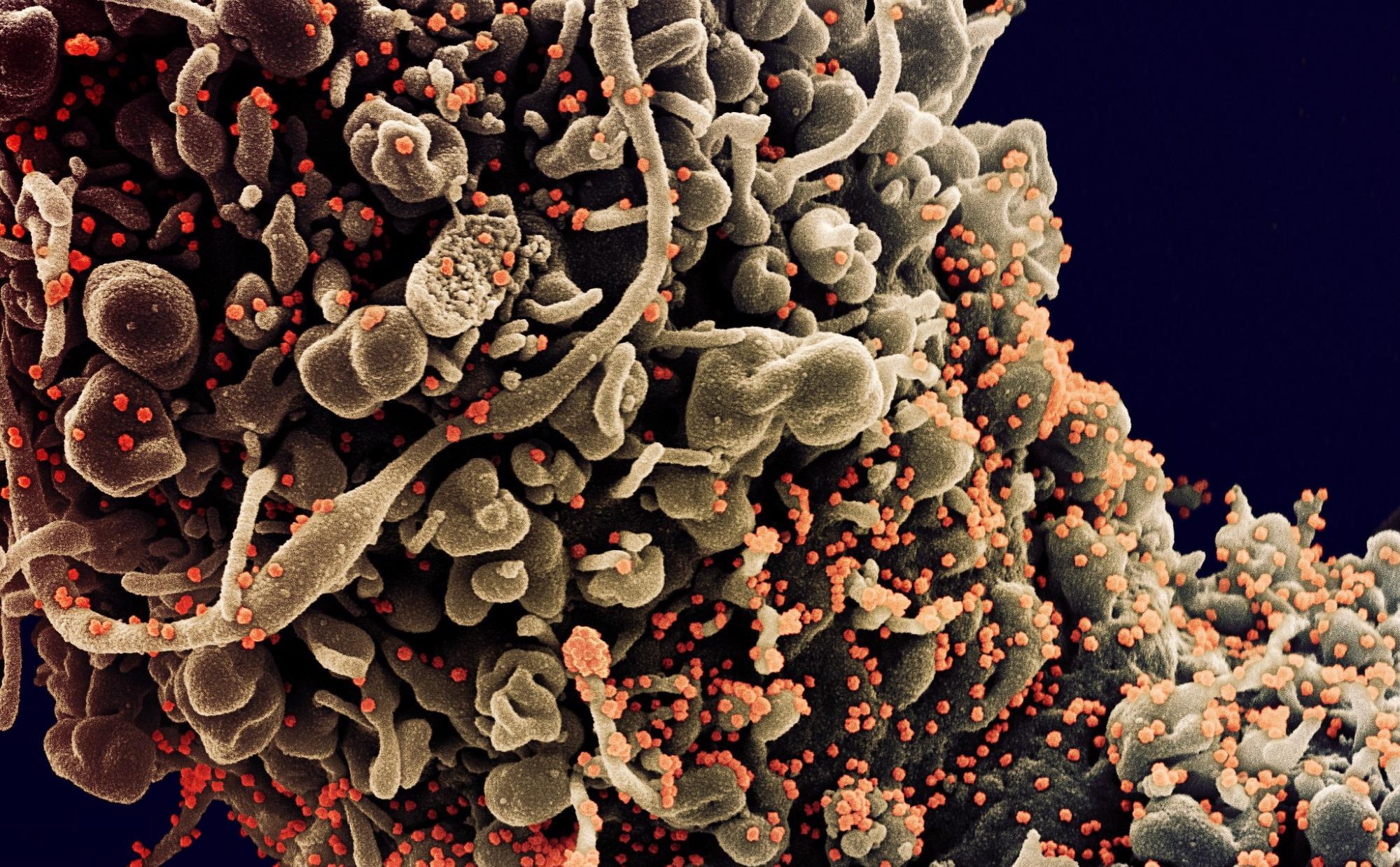 Study: Tuftsin: a natural molecule against SARS-CoV-2 infection. ​​​​​​​Image Credit: NIAID