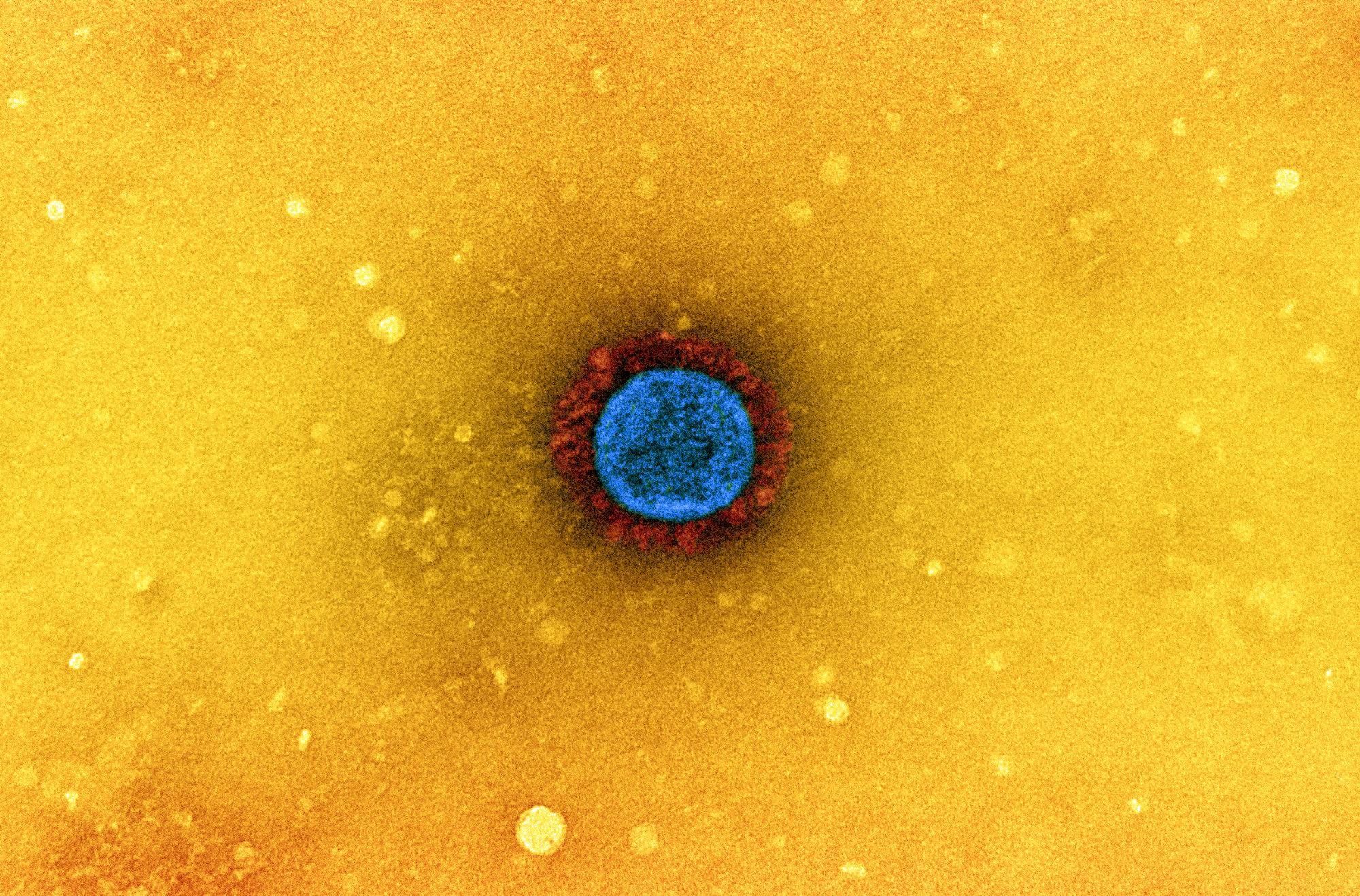 Study: Nirmatrelvir, Molnupiravir, and Remdesivir maintain potent in vitro activity against the SARS-CoV-2 Omicron variant. Image Credit: NIAID