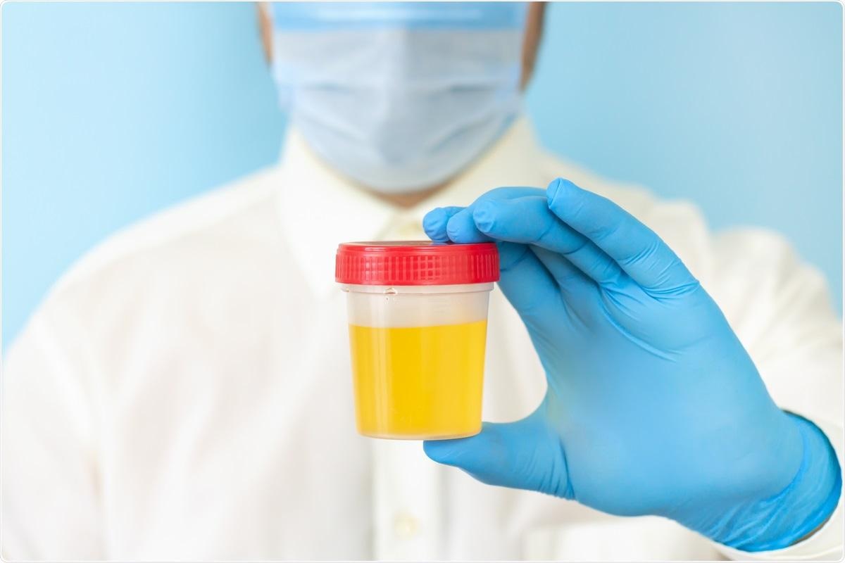 Study: Predictive performance and clinical application of COV50, a urinary proteomic biomarker in early COVID-19 infection: a cohort study. Image Credit: Kristini / Shutterstock.com