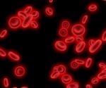 Study reveals peripheral blood biomarkers able to predict COVID-19 clinical outcomes in ICU admission