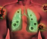 HP-XEMRI识别肺部肺部肺部肺部肺部肺炎患者的肺部疾病