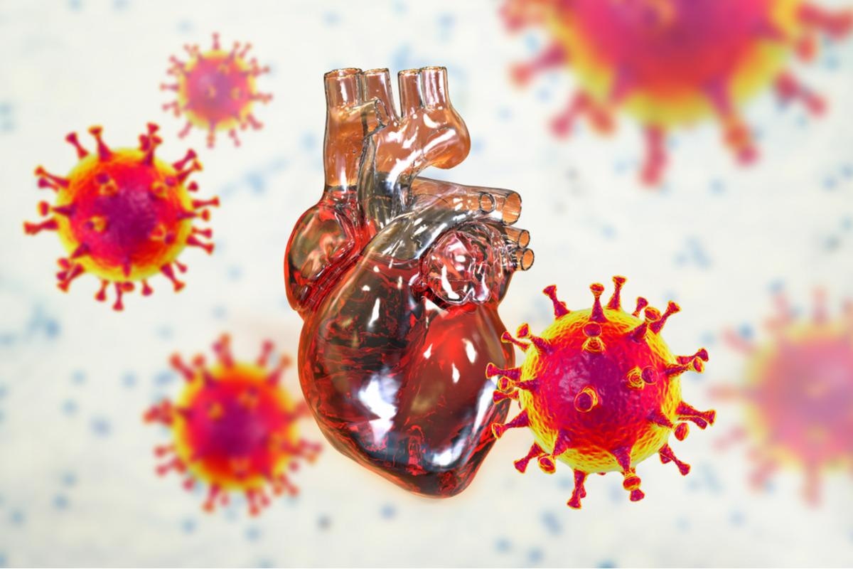 Study: Long-term cardiovascular outcomes of COVID-19. Image Credit: Kateryna Kon/Shutterstock