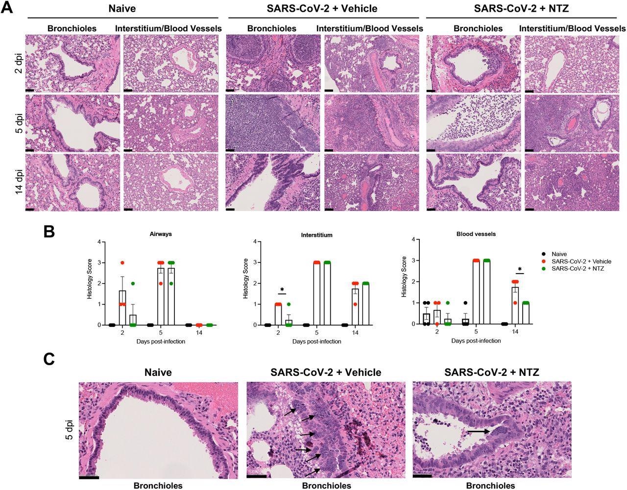 NTZ significantly prevents lung pathology SARS-CoV-2 infected Syrian hamsters. A. Comparison of normal lung (naïve) to pathologic changes induced by SARS-CoV-2 in vehicle-vs. NTZ-treated animals at day 2, 5, and 14 post-infection. Lung pathology at 5 dpi was severe irrespective of treatment group. B. NTZ significantly reduced interstitial inflammatory and perivascular scores at 2 and 14 days post-infection. Qualitatively there was decreased bronchiole epithelial injury and associated luminal inflammatory exudate. Lung pathology at 5 dpi was severe irrespective of treatment group. Asterisk indicates statistically significant differences by one-tailed unpaired Student’s t-test at day 2 for interstitium and on day 14 for blood vessels. Lungs from 4 animals were included in the scoring analysis for each timepoint except for 2 dpi, where there were 3 SARS-CoV-2 PBS/vehicle-treated animals. C. Bronchiole syncytial cells were observed exclusively at 5 dpi in SARS-CoV-2-inoculated animals and were more frequently observed in the vehicle treated group. Scale bars: A, 100 μm; C, 50 μm.