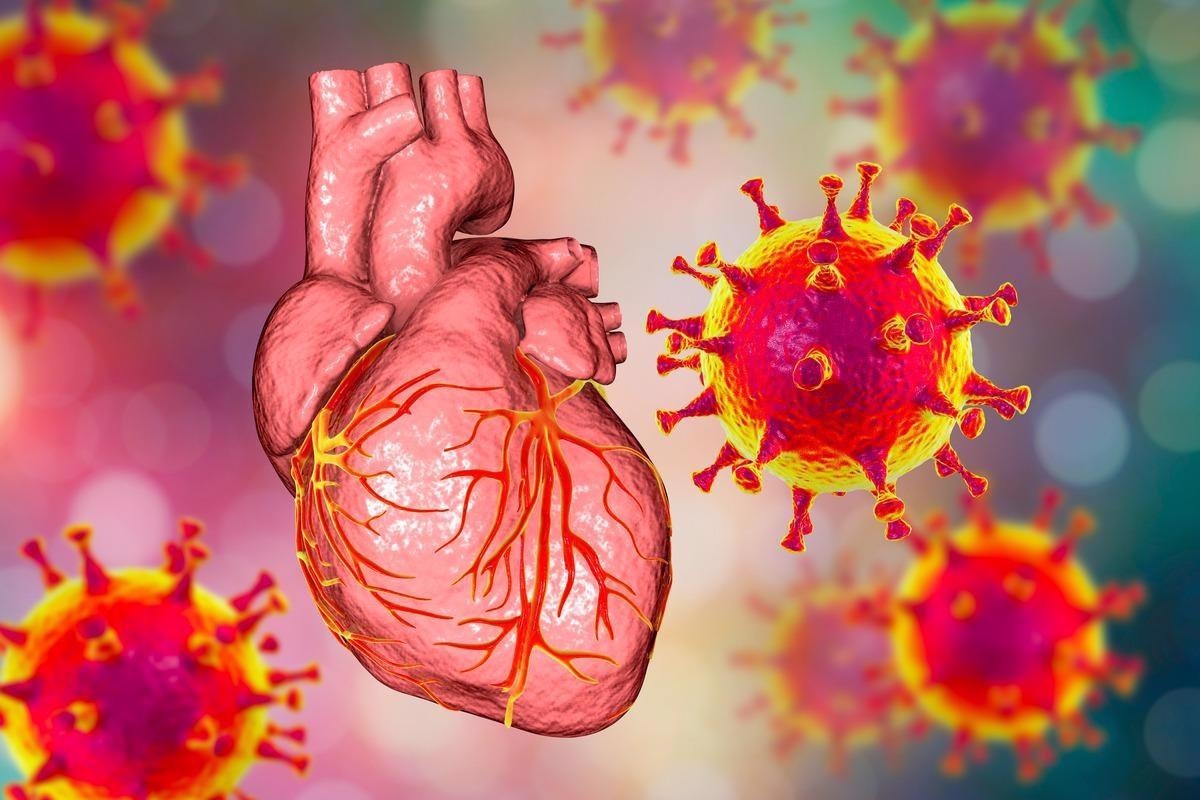 Study: Cardiovascular Signatures of COVID-19 Predict Mortality and Identify Barrier Stabilizing Therapies. Image Credit: Kateryna Kon/Shutterstock