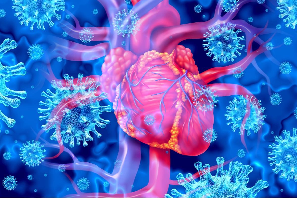 Study: Surveillance of Myopericarditis following COVID-19 Booster Dose Vaccination in a Large Integrated Health System. Image Credit: Lightspring/Shutterstock