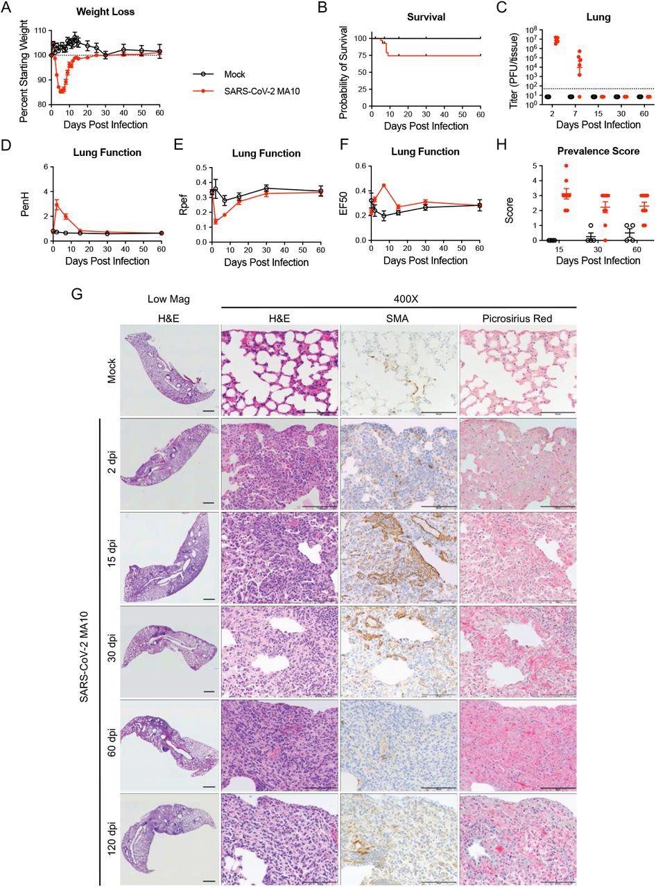 SARS-CoV-2 MA10 infection causes lung damage in aged surviving mice. 1-year-old female BALB/c mice were infected with 103 PFU SARS-CoV-2 MA10 (n=74) or PBS (n=24) and monitored for (A) percent starting weight and (B) survival. (C) Log transformed infectious virus lung titers were assayed at indicated time points. Dotted line represents limit of detection. Undetected samples are plotted at half the limit of detection. (D-F) Lung function was assessed by whole-body plethysmography for (D) PenH, (E) Rpef, and (F) EF50. (G) Histopathological analysis of lungs at indicated time points. H&E: hematoxylin and eosin. SMA: immunohistochemistry for α-smooth muscle actin. Picrosirius Red staining highlights collagen fibers. Image scale bars represent 1000 μm for low magnification and 100 μm for 400X images. (H) Disease incidence scoring at indicated time points: 0 = normal; 0 = 0% of total area of examined section, 1 = < 5%; 2 = 6-10%; 3 = 11-50%; 4 = 51-95%; 5 = > 95%. Graphs represent individuals necropsied at each timepoint (C, H), with the average value for each treatment and error bars representing standard error of the mean (A-H).