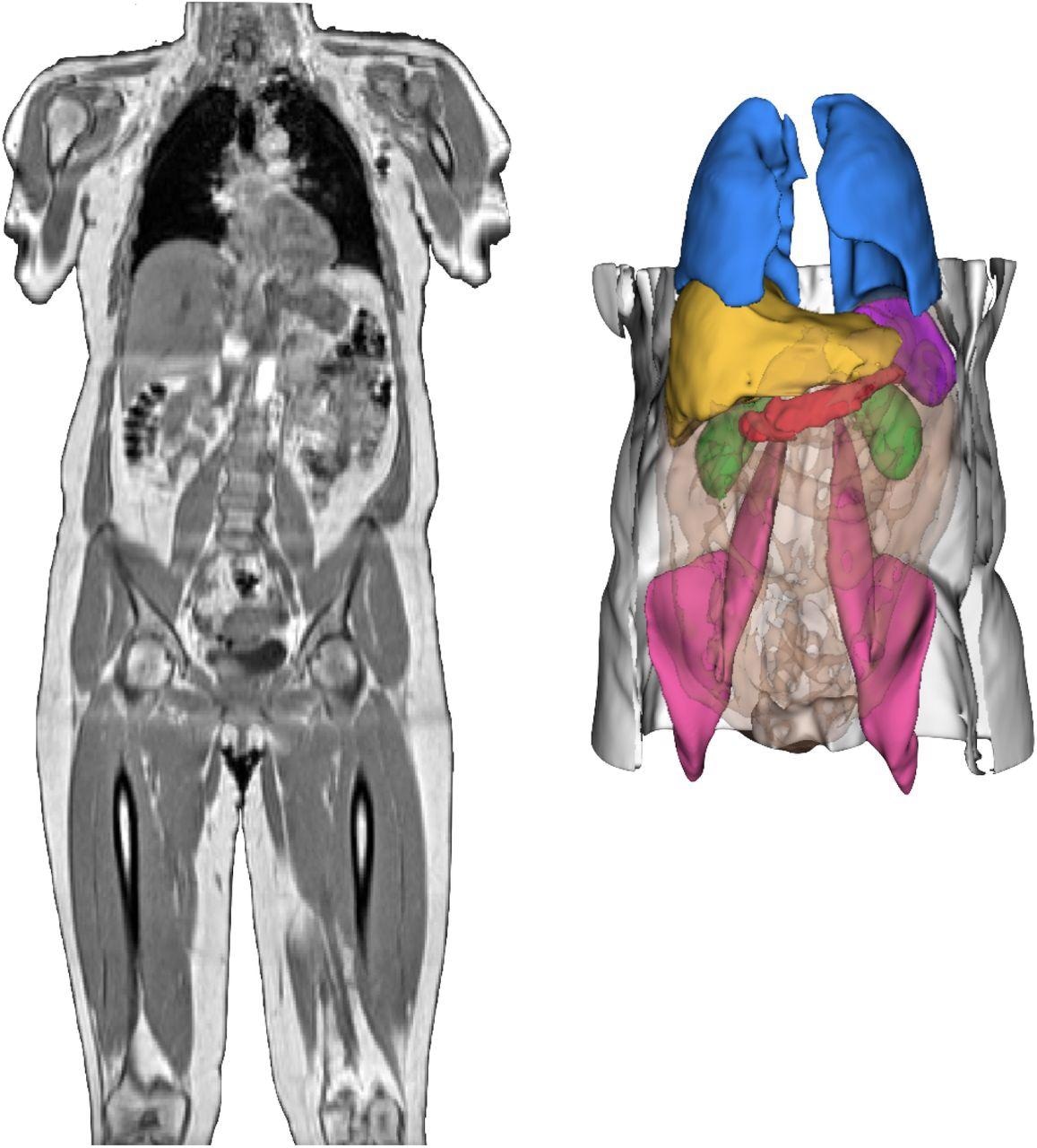 Neck-to-knee UK Biobank MRI acquisition of a COVID-19 study participant and 3D renderings of image-derived phenotypes obtained after image preprocessing and segmentation pipelines for that same participant. 3D segmentations: Liver (yellow), lungs (blue), spleen (purple), kidneys (green), abdominal subcutaneous adipose tissue (white), visceral adipose tissue (orange transparent), iliopsoas muscles (pink), pancreas (red).