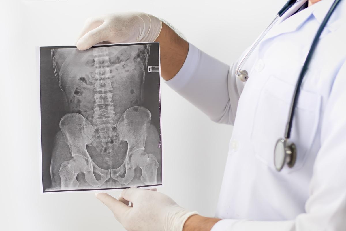 Study: Open Access Immunogenicity of COVID-19 vaccination in patients with ankylosing spondylitis: a monocentric prospective belgian cohort study. Image Credit: BENCHAMAT/Shutterstock