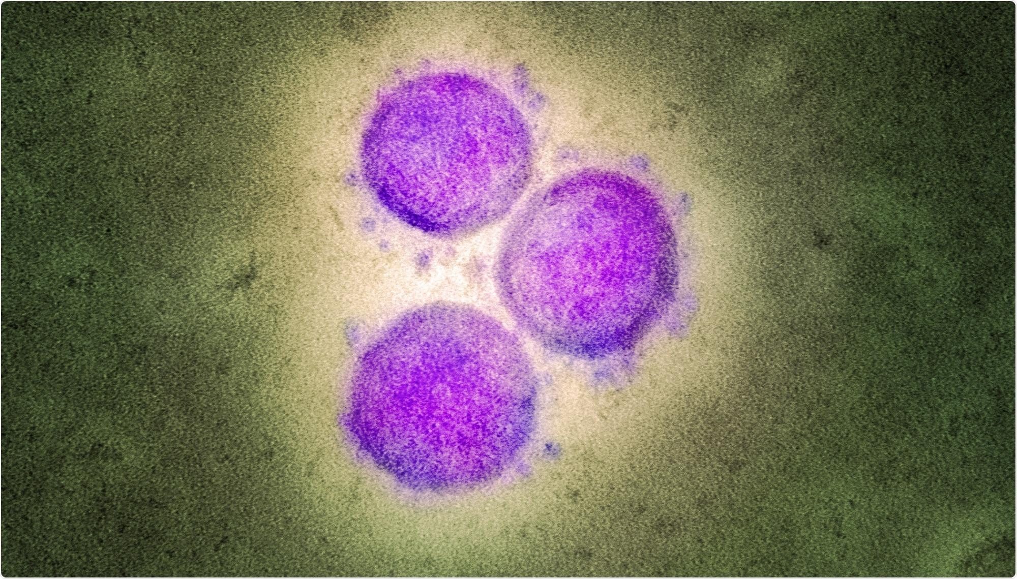 Study: NOVEL RT-qPCR ASSAYS ENABLE RAPID DETECTION AND DIFFERENTIATION BETWEEN SARS-COV-2 OMICRON (BA.1) AND BA.2 VARIANTS. Image Credit: NIAID