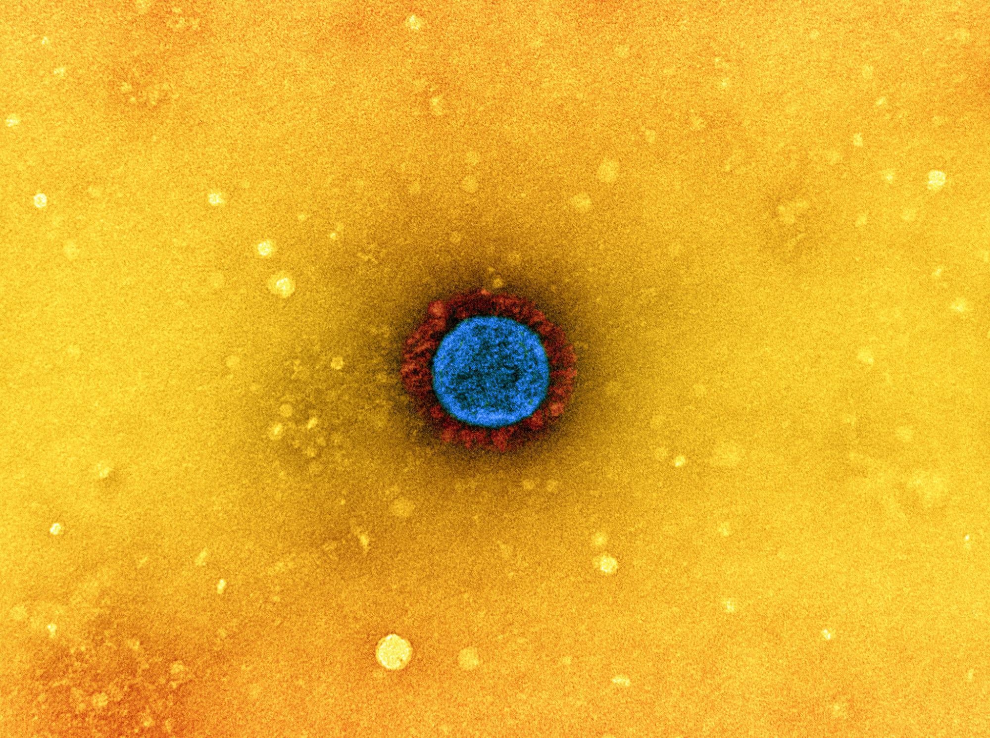 Study: Intragenomic rearrangements of SARS-CoV-2 and other β-coronaviruses. Image Credit: NIAID