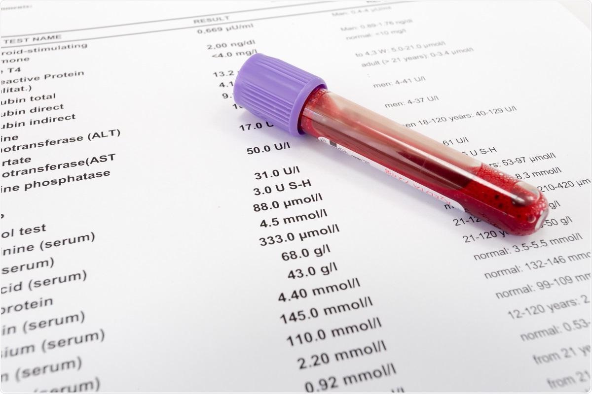 Study: Biomarkers Associated with Cardiovascular Disease in COVID-19. Image Credit: IvanRiver / Shutterstock.com