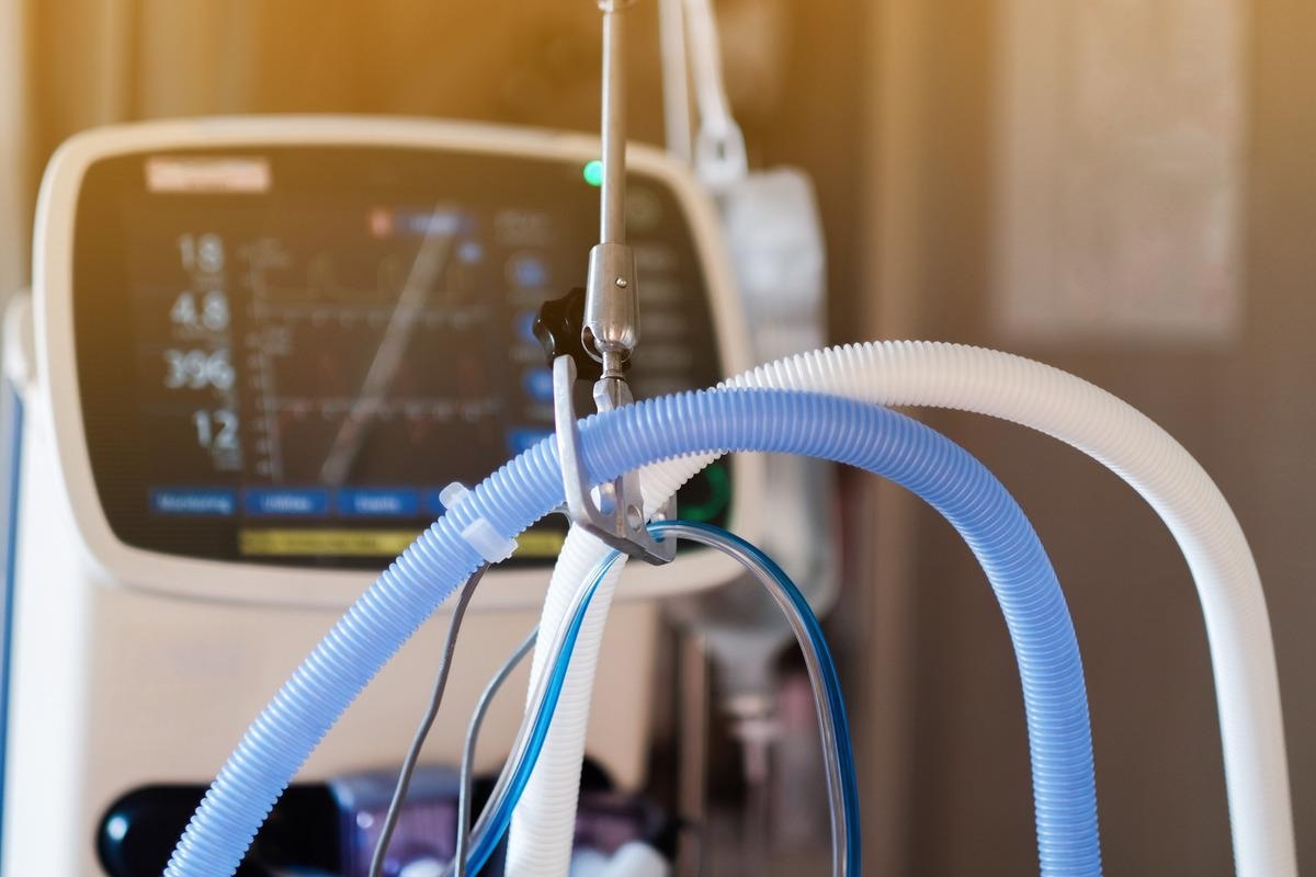Study: Circulating Levels of PD-L1, TIM-3 and MMP-7 Are Promising Biomarkers to Differentiate COVID-19 Patients That Require Invasive Mechanical Ventilation. Image Credit: Horth Rasur/Shutterstock