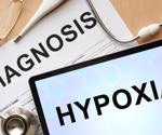 Hypoxia-inducible factors and SARS-CoV-2 manifestations