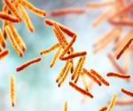 Study explores decline in tuberculosis cases during COVID-19 pandemic in the United States