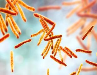 Study explores decline in tuberculosis cases during COVID-19 pandemic in the United States