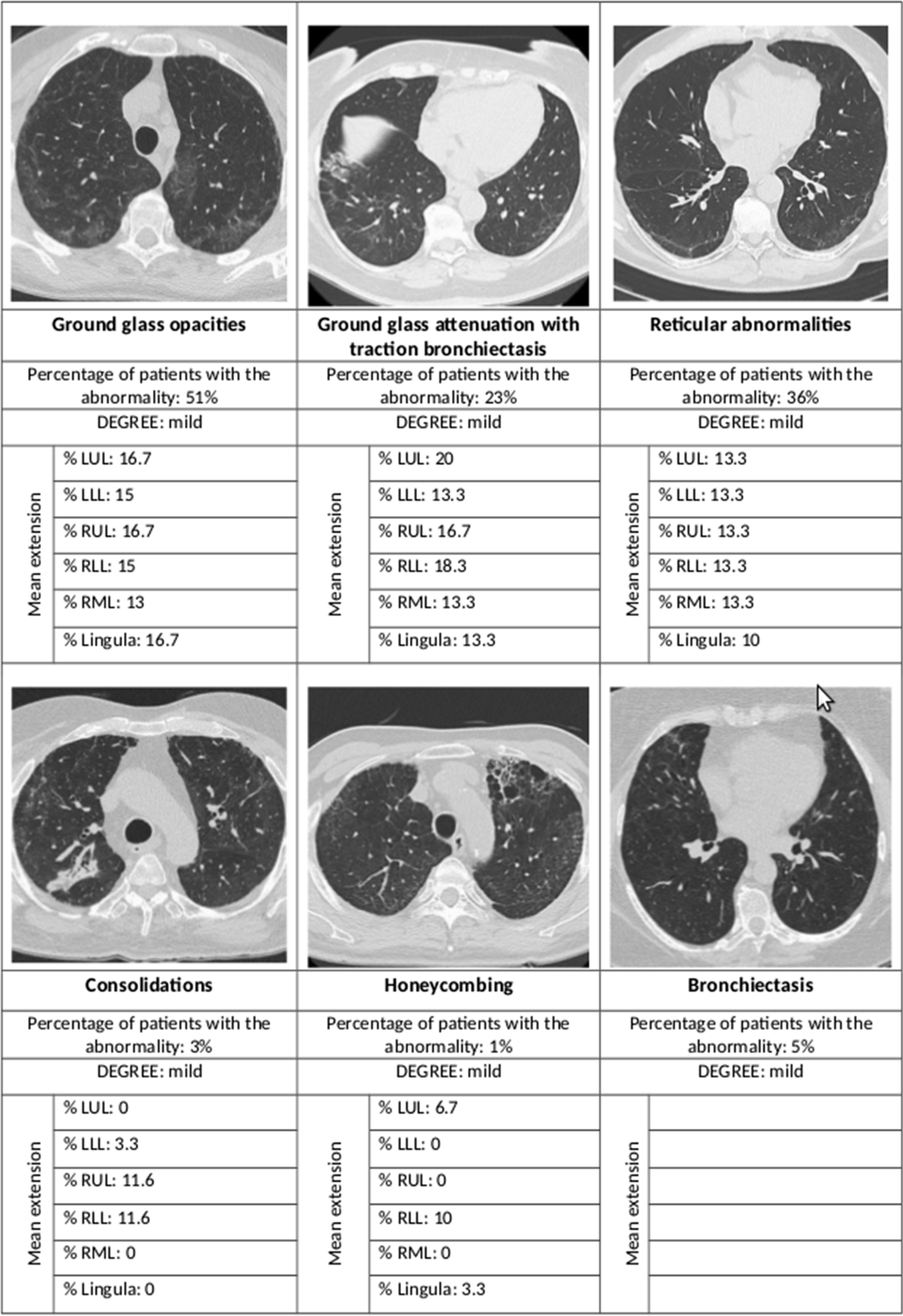 Summary of the main radiological abnormalities and their extension according to the lung lobe involved. LUL left upper lobe, LLL left lower lobe, RUL right upper lobe, RLL right lower lobe, RML right middle lobe