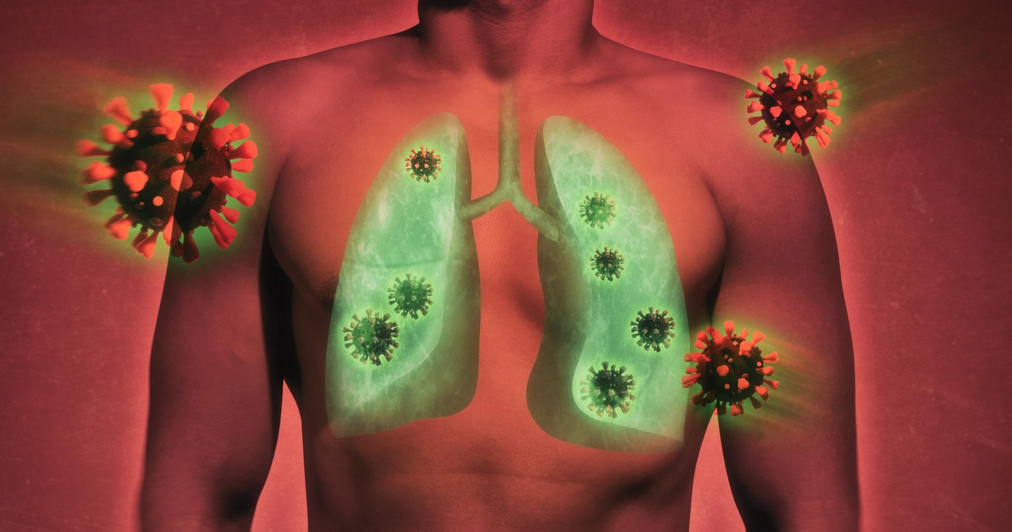 Study: One-year pulmonary impairment after severe COVID-19: a prospective, multicenter follow-up study. Image Credit: SvetaZi / Shutterstock