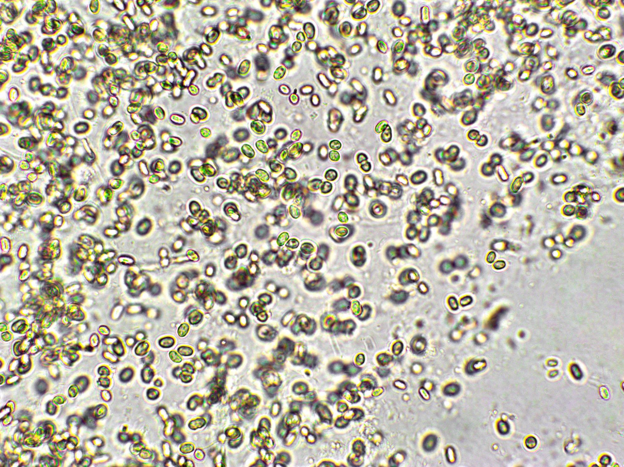 Studie: Alge Chlorella vulgaris unter mikroskopischer Sicht. Bildnachweis: Elif Bayraktar / Shutterstock