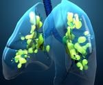 Liposomes tailored for pulmonary delivery for treating acute respiratory distress syndrome