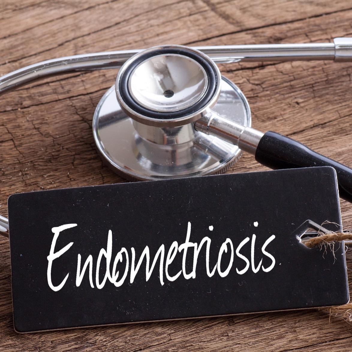 Sonographers take 64% more time to scan for endometriosis than routine pelvic ultrasounds, study shows