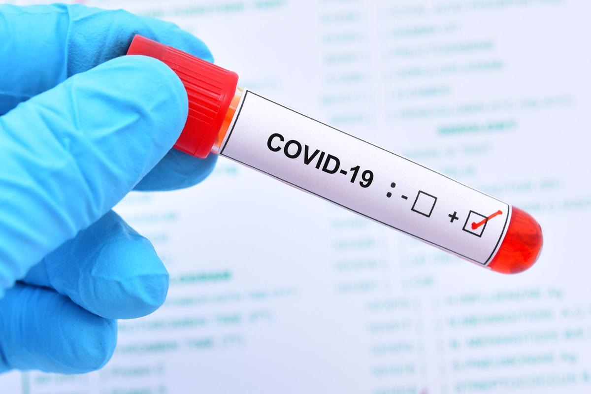 Study: Notes from the Field: SARS-CoV-2 Omicron Variant Infection in 10 Persons Within 90 Days of Previous SARS-CoV-2 Delta Variant Infection — Four States, October 2021–January 2022. Image Credit: Jarun Ontakrai / Shutterstock.com