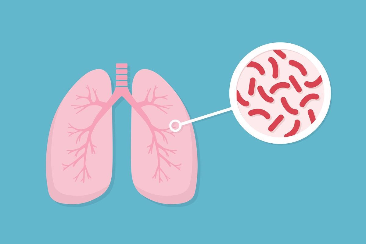 Study: Application of Artificial Intelligence to Monitoring of Medication Adherence for Tuberculosis Treatment in Africa: A Pilot Study. Image Credit: doyata/Shutterstock