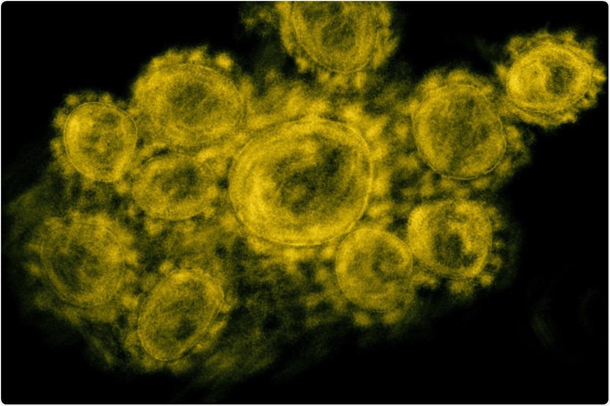 Study: The Delta variant SARS-CoV-2 spike protein uniquely promotes aggregation of pseudotyped viral particles. Image Credit: NIAID