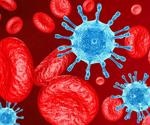 Fully vaccinated HIV patients may be less susceptible to develop severe breakthrough SARS-CoV-2 infection
