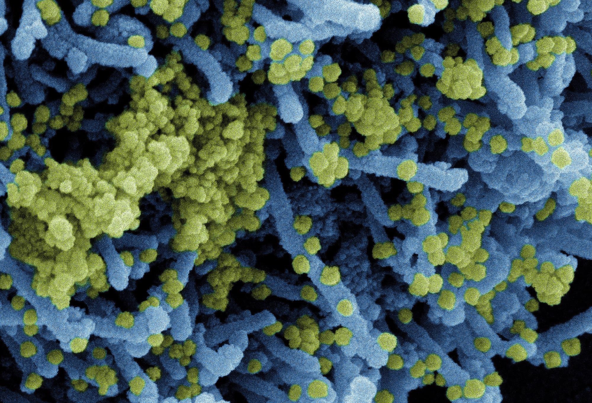 Study: SARS-CoV-2 vaccination can elicit a CD8 T-cell dominant hepatitis. Image Credit: NIAID