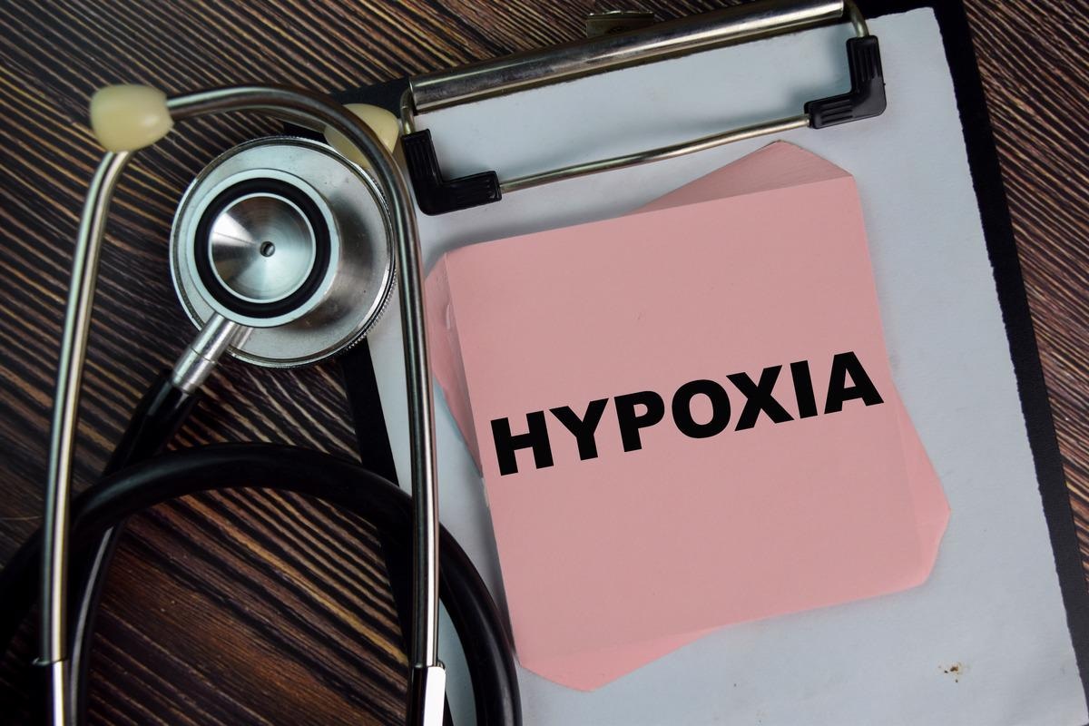 Study: Silent hypoxia is not an identifiable characteristic in patients with COVID-19 infection. Image Credit: bangoland/Shutterstock