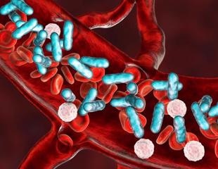 How is the Antimicrobial Resistance Crisis Impacting Sepsis?