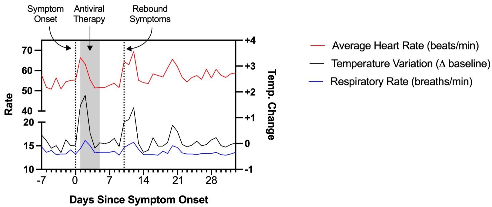 Physiologic measurements as recorded by a personal fitness device used by Patient 1, showing rebound tachycardia, tachypnea, and elevated body temperature coinciding with completion of antiviral therapy.