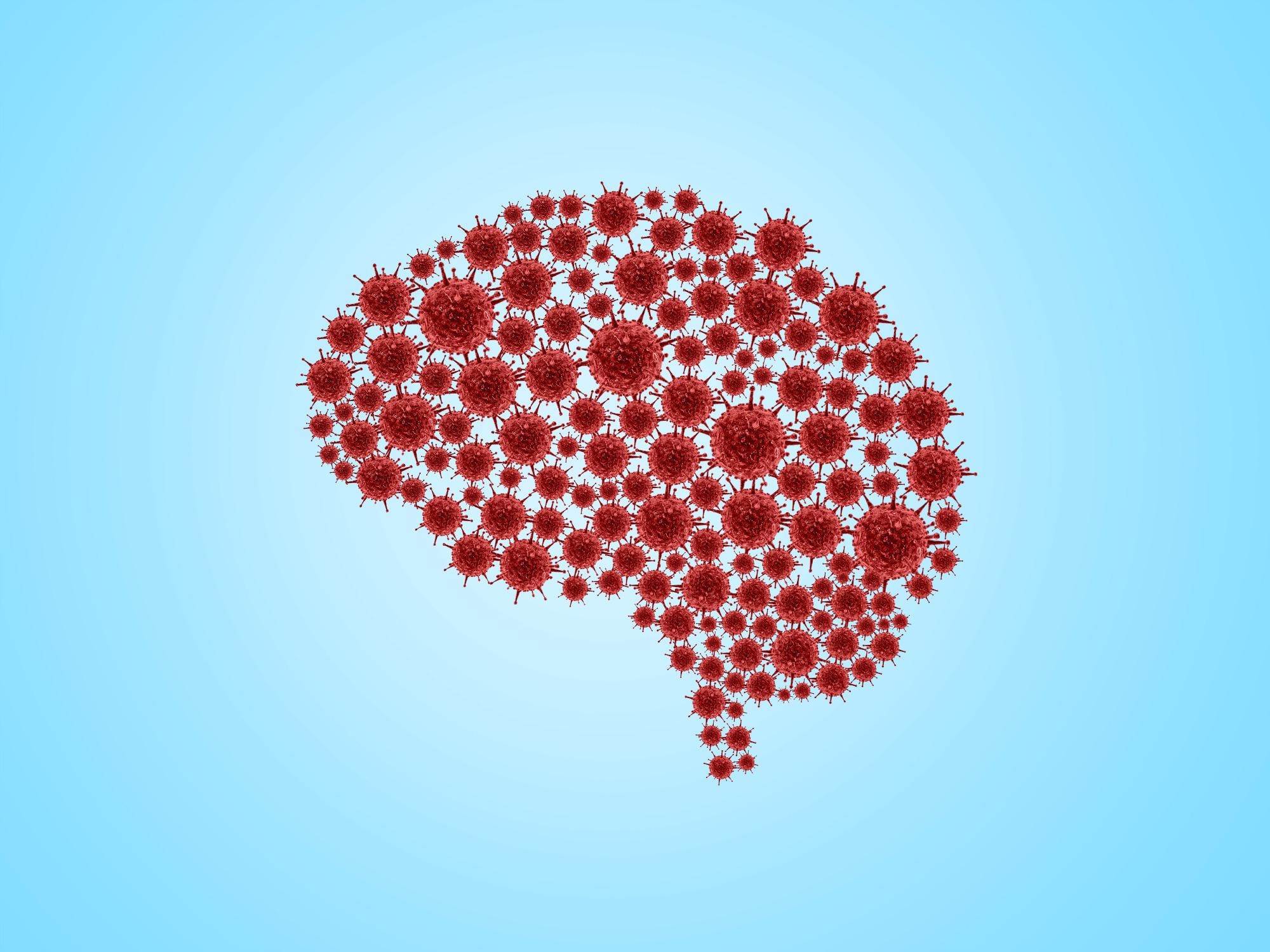 Study: Decreased cerebral blood flow in non-hospitalized adults who self-isolated due to COVID-19. Image Credit: DOERS / Shutterstock