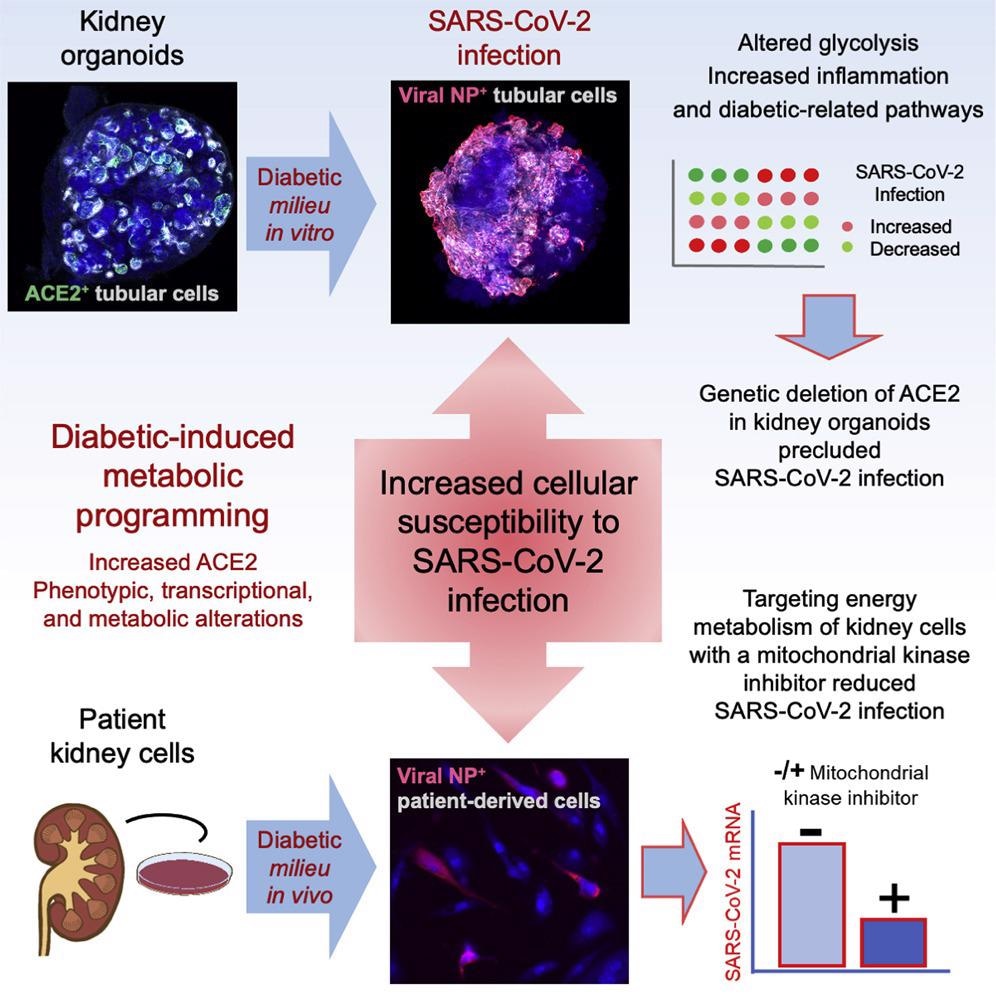 Study: A diabetic milieu increases ACE2 expression and cellular susceptibility to SARS-CoV-2 infections in human kidney organoids and patient cells. Image Credit: Cell Press