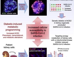 Why do diabetic patients have more severe SARS-CoV-2 infections?