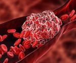 Incidence of arterial and venous thromboembolism and death in COVID-19 patients