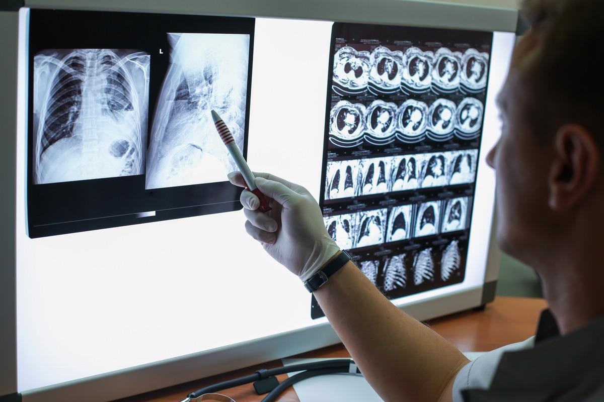 Study: An interpretable deep learning workflow for discovering subvisual abnormalities in CT scans of COVID-19 inpatients and survivors. Image Credit: Egor_Kulinich/Shutterstock