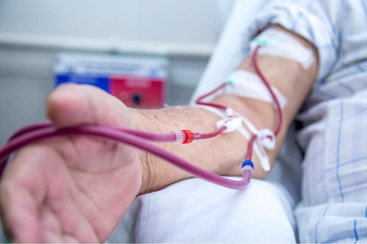 Study: SARS-CoV-2 Booster Effect and Waning Immunity in Hemodialysis Patients. Image Credit: mailsonpignata/Shutterstock