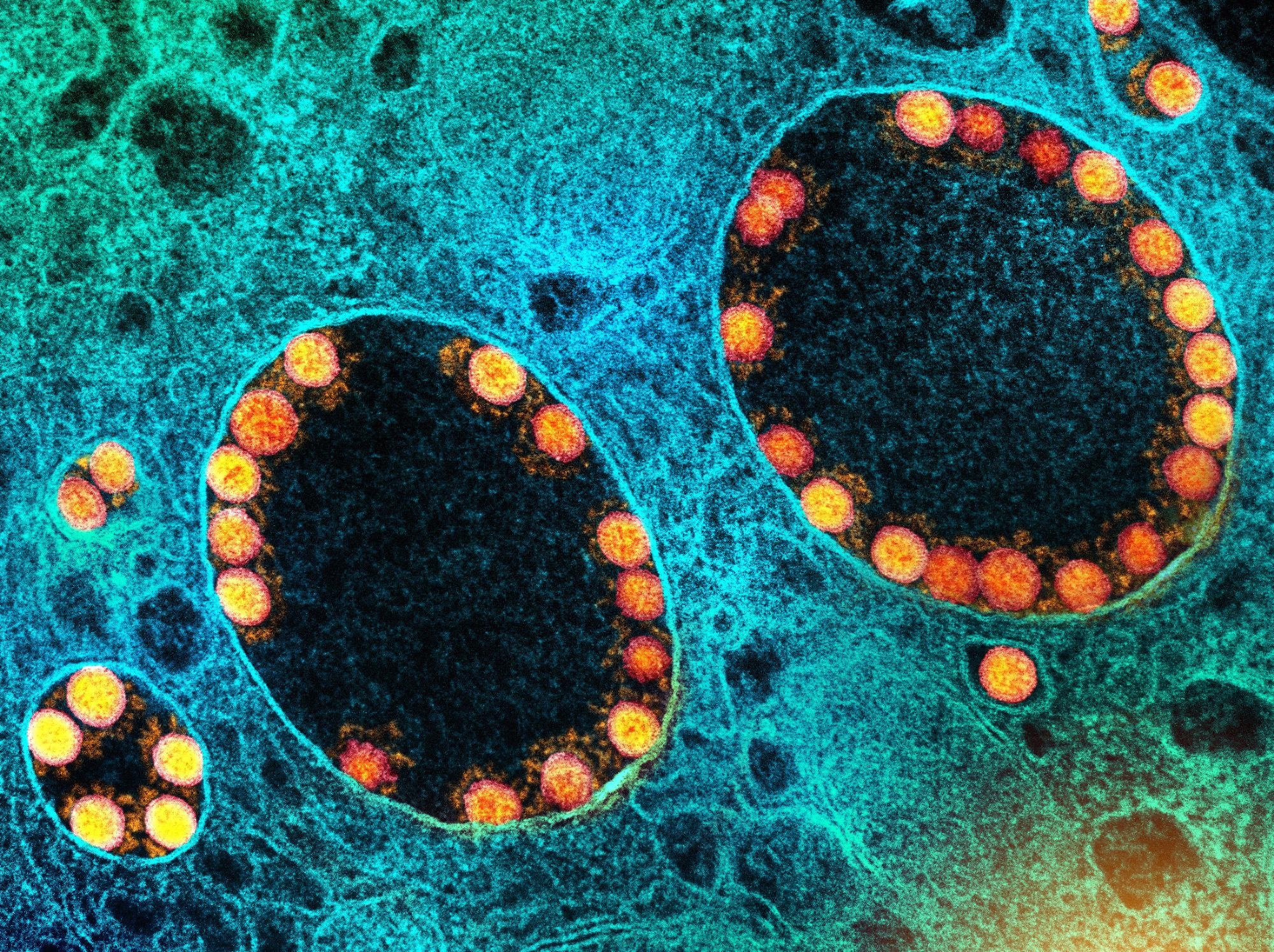 Study: A Multitrait Locus Regulates Sarbecovirus Pathogenesis. Image Credit: NIAID