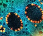 Sarbecovirus pathogenesis regulated by a multitrait locus